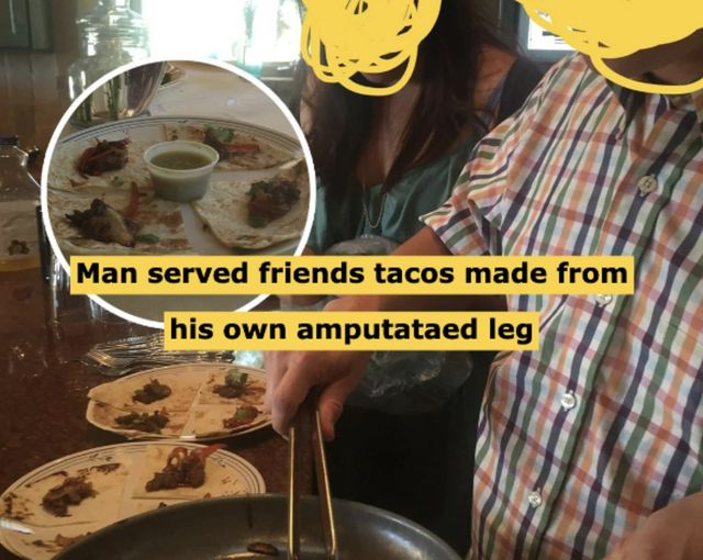 Man Served Tacos Made from His Own Amputated Leg