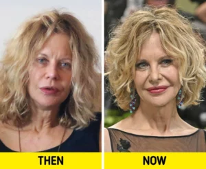 At the Met Gala, Meg Ryan makes a rare appearance after twenty years, and she seems to be completely unrecognizable.