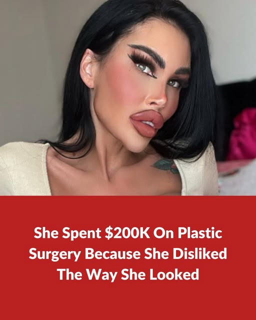 Plastic surgery addict spends $200K on plastic surgery
