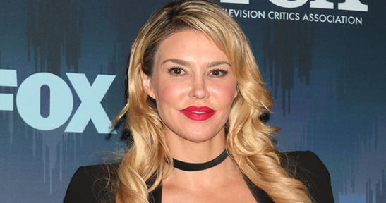 Sad truth about Brandi Glanville’s face